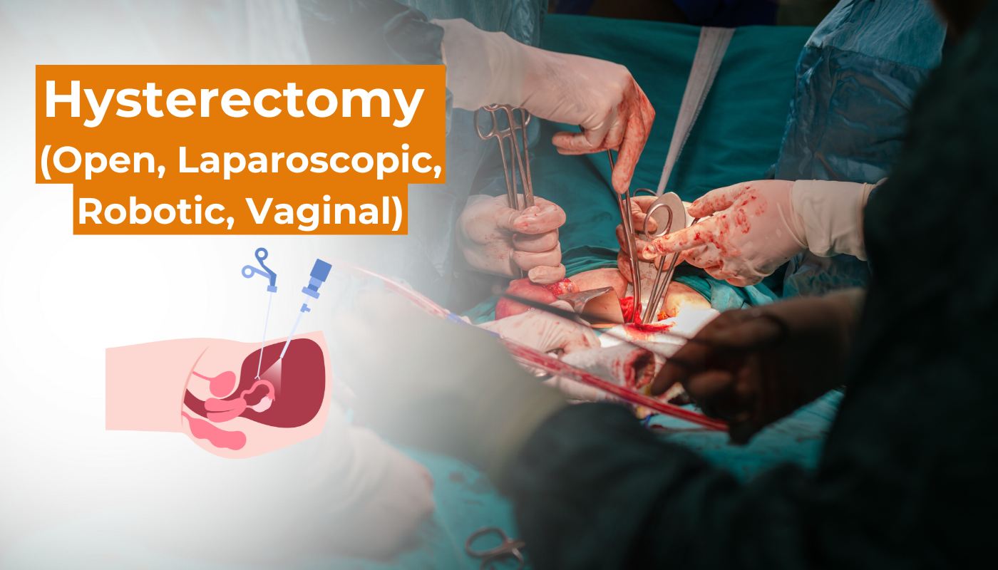 Hysterectomy (Open, Laparoscopic, Robotic, Vaginal)